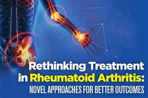 A Novel Approach To Arthritis Treatment